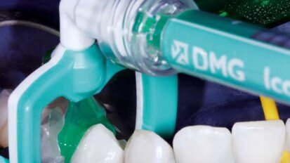 Τρόχισμα με ...τζελ