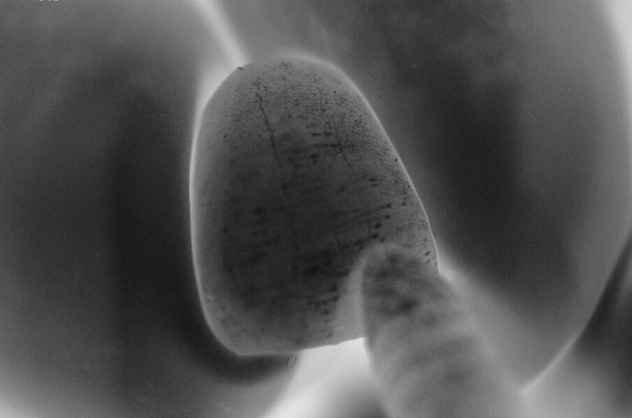 Fig. 16 - Utilizzo un cono di vetro-carta per levigare la superficie.