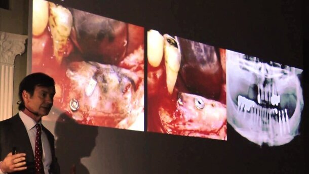 „Kierunki dla implantologii i inżynierii tkankowej” – 12. Kongres OSIS