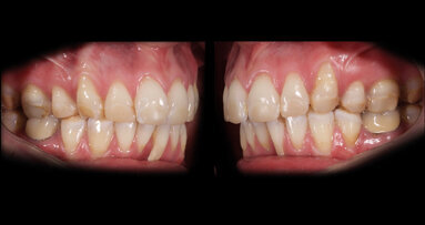 Ricostruzioni estetiche complesse: metodi digitali e protocolli operativi integrati