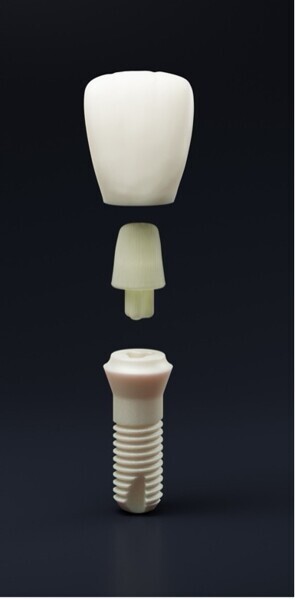 Fig. 11 : Système d’implant full zircone très stable sur le plan électrochimique. Une alternative sérieuse aux systèmes implantaires en titane. Pas de péri-implantite survenue sur une longue période d’observation de douze ans.73