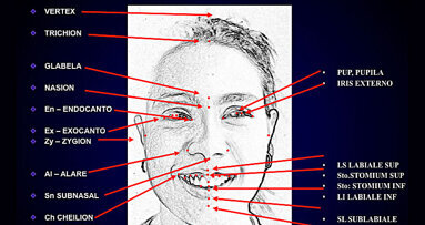 Asertividad en estética dental