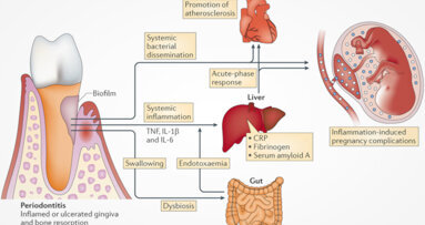 Periodontist Dr Chris Barker talks successful periodontitis treatment