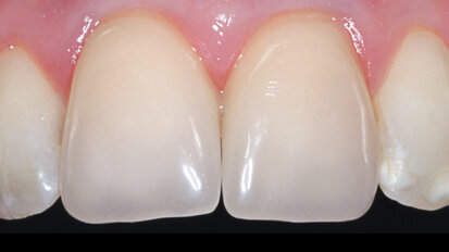 Multichromatická hybridní keramika: Přechody odstínů na stisknutí tlačítka