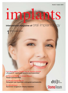 implants Czech Republic No. 1, 2019