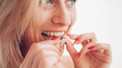 Study establishes patient motivations for seeking clear aligner therapy across five European countries