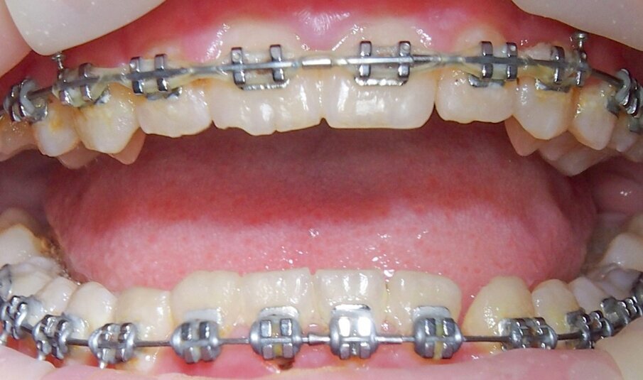 Fig. 2 - Situazione iniziale.