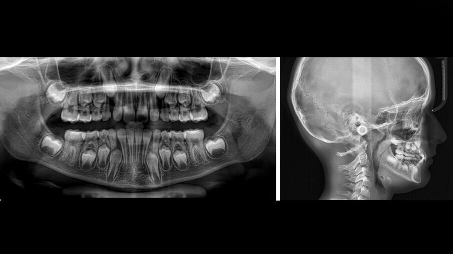 Figg. 8a, 8b_Record radiografici postrattamento.