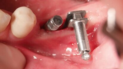 Experte erläutert Technik der Winkelmodulation Experte erläutert Technik der Winkelmodulation