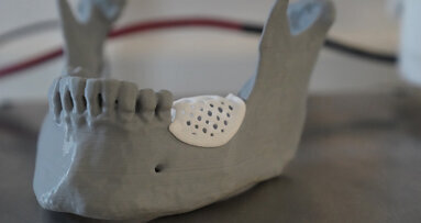 Breakthrough in guided bone regeneration: 3D printing paves the way for advanced scaffolds