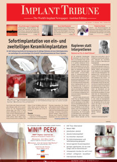 Implant Tribune Austria No. 2, 2014