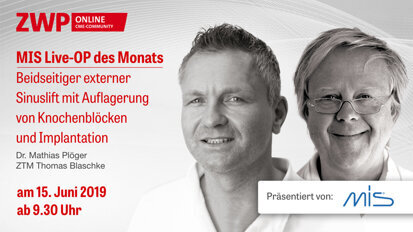 Live-OP am 15. Juni zum beidseitigen externen Sinuslift Live-OP am 15. Juni zum beidseitigen externen Sinuslift