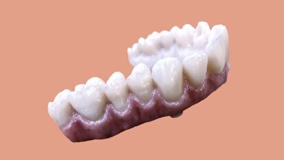 Nobel Biocare and DOCERAM Medical Ceramics expand partnership Nobel Biocare and DOCERAM Medical Ceramics expand partnership