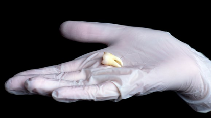 Un análisis de los dientes ofrece mayor precisión para detectar la edad