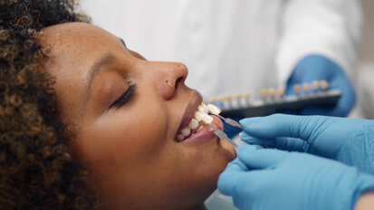 Align Technology introduces its first professional whitening system in the UK