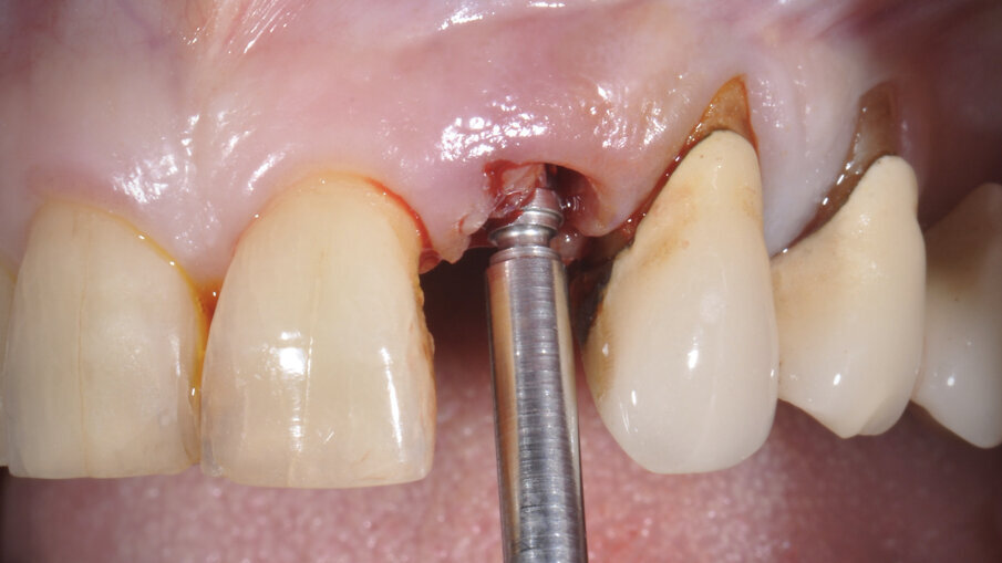 Fig. 4_Impianto in sede.