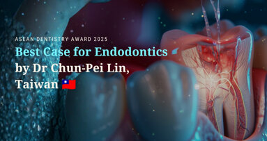 ASEAN Dentistry Award 2025 winners showcase: Best Case for Endodontics