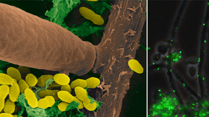 Interaktion verschiedener Pathogene verantwortlich für Kariesbildung
