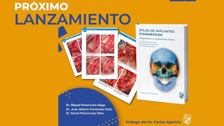 Nuevo “Atlas de implantes cigomáticos”