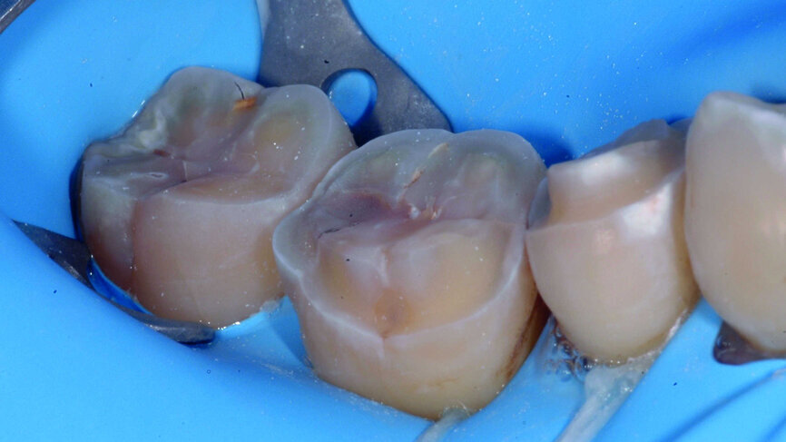 Fig. 4b : Vue des préparations.