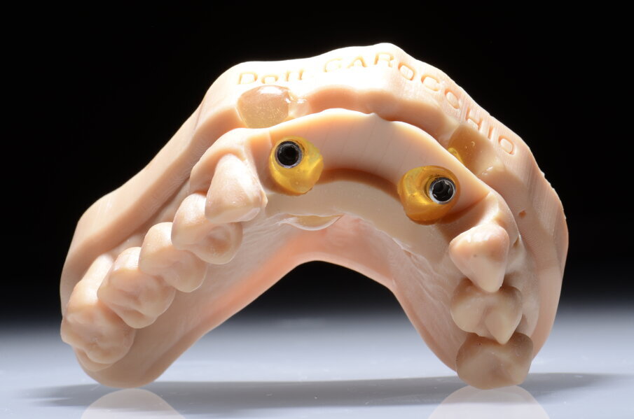 Fig. 43 - Analoghi bloccati sul modello master iniziale. 