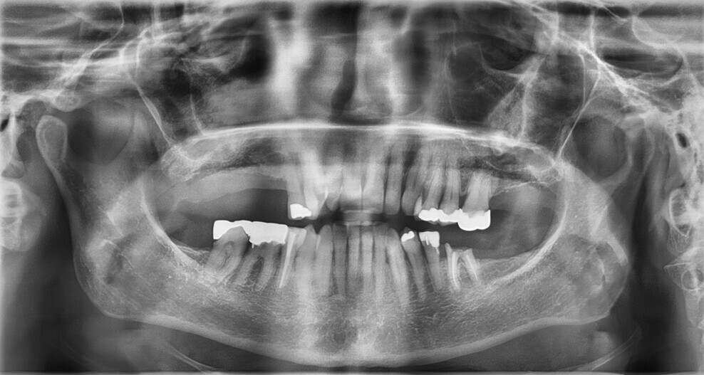Fig. 2: Pre-op radiographic assessment.