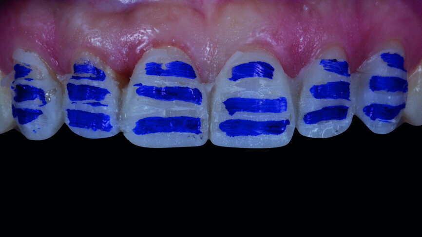 Fig. 9a: Preparation through the mock-up.