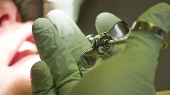 Irrigation dynamics in root canal therapy