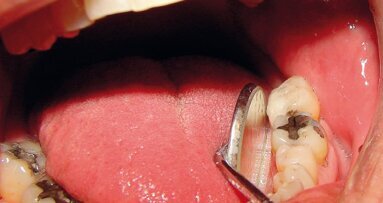 “La medicina e l’odontoiatria biologica fra tradizione ed innovazione: uso dei metalli pesanti, aspetti clinici e legali”