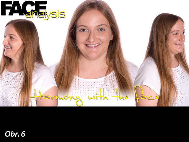 Estetický dopad vzhledu frontálních zubů na celkový vzhled pacientky.