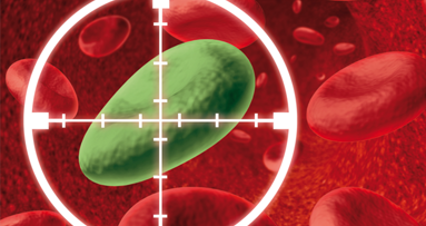 Gutartiges Bakterium A12 bekämpft Karies