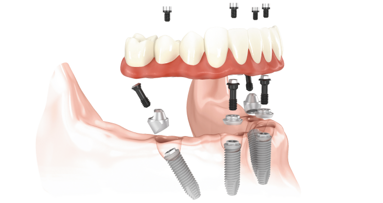 MALO CLINIC Protocol