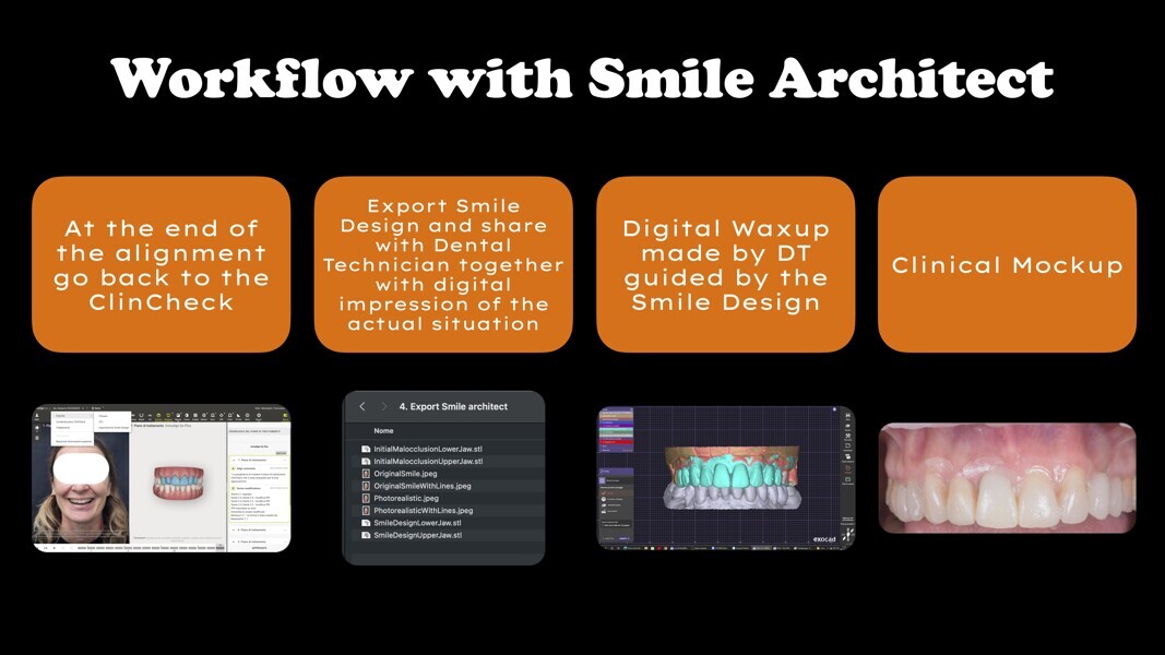 Fig. 14: Workflow with Invisalign Smile Architect for communication with the laboratory.