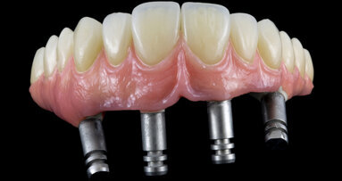 Kouzelné „ALL ON FOUR“