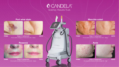 Potenzia il tuo Studio Odontoiatrico con Candela Medical