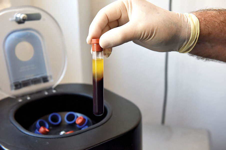 Fig. 9: Following phlebotomy, the patient’s blood is centrifuged at 2,200 rpm for three minutes.  