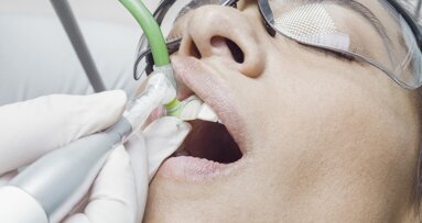 La prevención de la periimplantitis debe comenzar en la planificación de los implantes