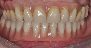 Reconstructive Periodontal Plastic Surgery course held in Lahore