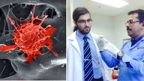 Cientistas desenvolvem nova geração de implantes dentais