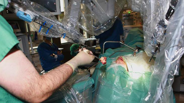 Erste totale Kehlkopfentfernung mit dem Da-Vinci-Roboter