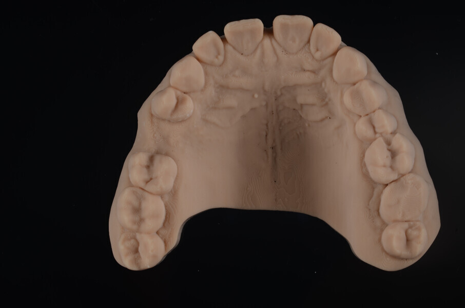 Fig. 4b: Initial models 3D-printed from Asiga DentaMODEL using the MAX UV, occlusal view.