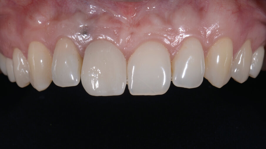 Fig. 35_Foto finali.