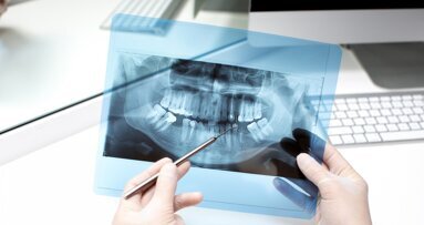 Ocena wieku na podstawie trzecich zębów trzonowych nie ma potwierdzenia naukowego