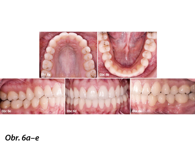 Výsledek ošetření.
