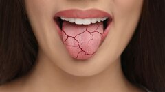 Kunstmatig speeksel uit hydrogelreservoir verlicht xerostomie