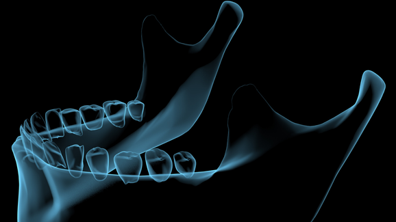 Virtuell in Zahn und Kiefer: 7. DDT in Hagen
