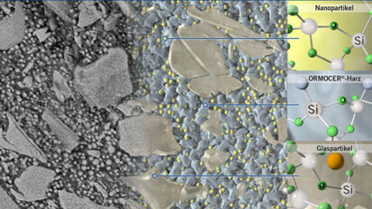 Webinar präsentiert Wissenswertes zu neuartigem Füllungsmaterial