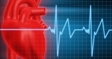 Zahnverlust erhöht das Risiko für Herzinfarkt