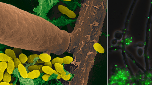 Interaktion verschiedener Pathogene verantwortlich für Kariesbildung