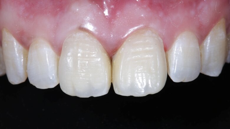Fig 18 After 48 hours of rehydration